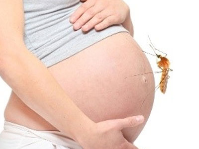 Một thai phụ nhiễm Zika sinh con không bị tật đầu nhỏ