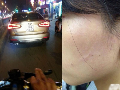 Công an triệu tập tài xế ô tô tát cô gái vì "không nhường đường"