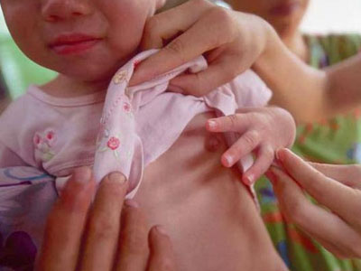 Bé gái mẫu giáo đau ngực, vòng 1 to bất thường vì mẹ bật đèn ngủ suốt nhiều năm