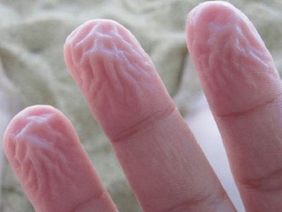 9 phản ứng kỳ lạ nhưng rất phổ biến của cơ thể