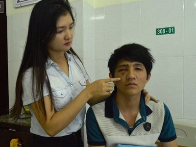 Thanh niên tự "đập mặt" vào gậy CSGT khiến hốc mắt bị lún