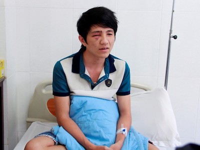 "Thanh niên không làm chủ tốc độ nên va mặt vào gậy CSGT"