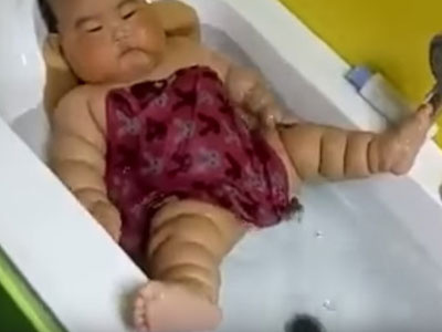 Sự thật bất ngờ đằng sau hình ảnh em bé bụ bẫm người nần nẫn ngấn