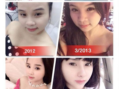 Hotmom 9X từng gây sốc vì "đập mặt xây lại" khiến dân tình xôn xao vì hình ảnh mới nhất