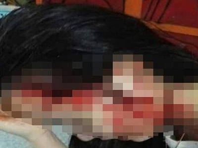 Cô gái bị hành hung trên xe taxi: Cô giáo cấp 2 bị tố có tham gia