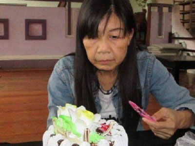 Cư dân mạng xót xa cô gái 21 tuổi có gương mặt lão hóa như cụ 80