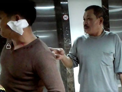 Hà Nội: Cư dân "tố" bị nhóm bảo vệ chung cư đánh rách tai chỉ vì thắc mắc chỗ đỗ ô tô