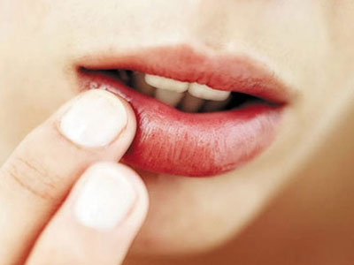 Nếu không đánh son mà thấy môi có màu như này thì bạn cần phải đi khám ngay