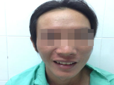 Chàng trai bỗng dưng mù trước ngày cưới vợ