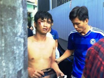 Lời khai của nam thanh niên ngáo đá, tự đổ nước mắm lên người dọa tự tử