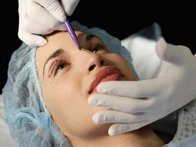 Cô gái mù mắt, liệt chân tay sau khi làm đẹp mũi