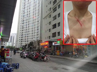 Hà Nội: Khuyên không nhổ nước bọt nơi công cộng, một phụ nữ bị đánh trong thang máy