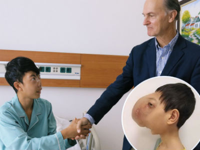 Thay đổi diệu kỳ của chàng trai Việt "không có mặt" qua 4 cuộc phẫu thuật của giáo sư Mỹ