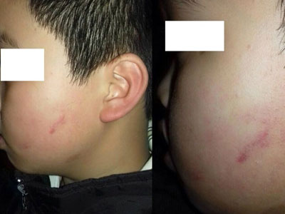 Góc nhìn của luật sư vụ cô giáo cho 42 học sinh tát bạn
