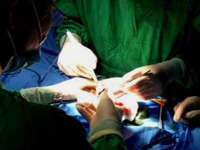 Chồng nhậu say đánh vợ, bị phản đòn đến rách "của quý"