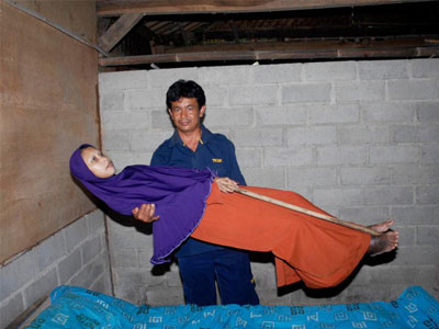 Căn bệnh lạ khiến cơ thể cô gái "cứng đơ như gỗ"