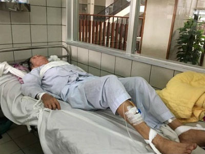 Người đàn ông say rượu chọc hỏng mắt vợ và cuộc "trốn chạy" khỏi viện tâm thần