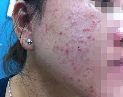 "Tai nạn" làm đẹp cấp tốc ngày tết