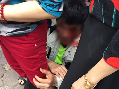 "Nếu không có người che chắn, tôi đã bị nhóm người nhầm là trộm xe SH đánh chết"