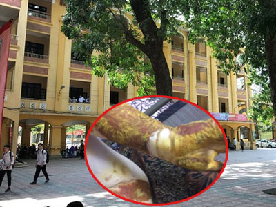 Sở GD-ĐT Hà Nội chỉ đạo xử lý nghiêm cá nhân liên quan đến vụ nổ khiến nữ sinh Phan Đình Phùng bị bỏng