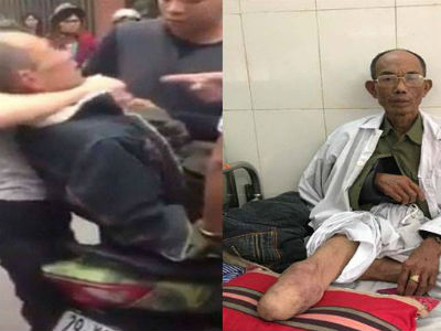 Khởi tố hai cha con hành hung thương binh do va chạm giao thông