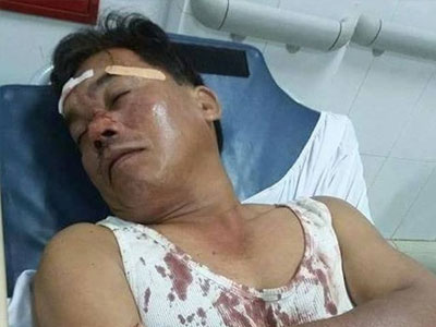 Can ngăn trai làng hỗn chiến, công an viên bị đánh gục tại chỗ