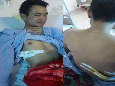 Chủ tịch tỉnh yêu cầu khẩn trương điều tra vụ thanh niên bị đâm vì đưa người đi cấp cứu