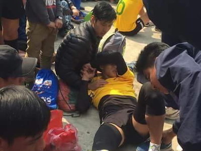 Thi đấu ở hội làng, một VĐV bóng chuyền bị gãy chân