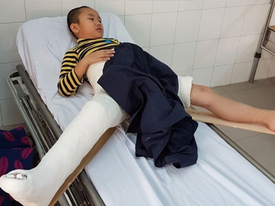Hai "sự thật" của cô hiệu trưởng về vụ xe đâm học sinh gãy chân