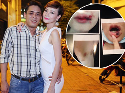 Những người đẹp từng cay đắng chia sẻ bị chồng bạo hành