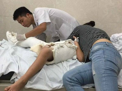 Hành trình nước mắt của ông bố có con gãy chân trong trường