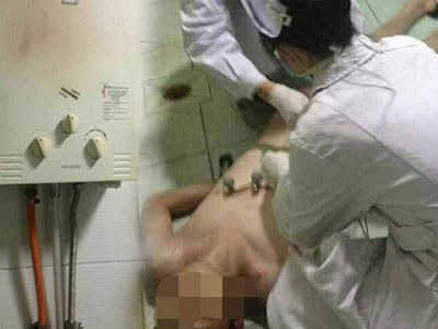 Con vừa tắm xong, 3 người trong gia đình phải nhập viện cấp cứu