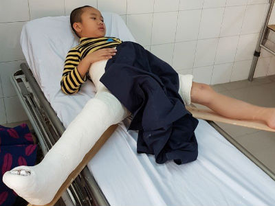 Vụ học sinh gãy chân: Công an Hà Nội đã có kết luận