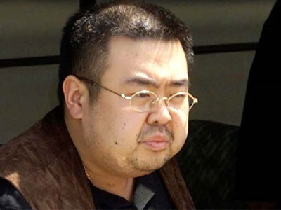 Chuyên gia: Jong Nam đã trải qua cái chết "vô cùng đau đớn"