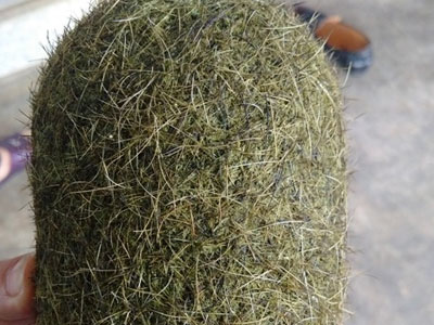 Phát hiện vật thể nghi "trư cát" nặng 1,1kg trong dạ dày lợn