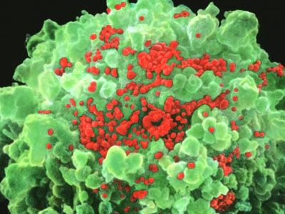 Chấn động: Vaccine AIDS cứu 5 bệnh nhân "sạch" HIV trong 7 tháng