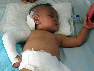 Cậu bé 15 tháng tuổi rơi từ tầng 5 xuống đất thoát chết thần kỳ