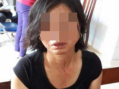 Con trai người phụ nữ bị chồng bạo hành tại Đồng Nai: “Mẹ bị cha dượng đánh suốt 23 năm nay"
