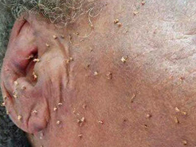 Đi lấy củi, bị đàn ong bâu kín người đốt 500 phát