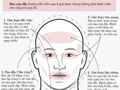 Ảnh bìa bài viết 438713