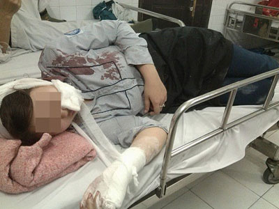 Bố nữ sinh bị đánh hội đồng bằng tuýp sắt: “Tôi sốc nặng khi nhận được điện thoại báo tin”