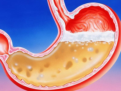 6 dấu hiệu phổ biến cảnh báo dạ dày gặp vấn đề