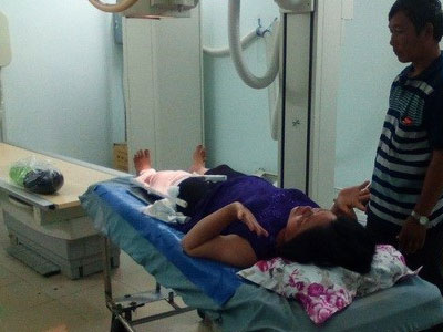 33 người ở Trà Vinh nhập viện vì… cán chó