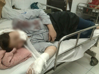Hà Nội: Triệu tập 2 nghi can dùng tuýp sắt đánh nữ sinh lớp 10 nhập viện