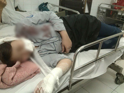 Vụ nữ sinh lớp 10 bị đánh bất tỉnh: Hẹn nhau giải quyết mâu thuẫn vì “dám” nhìn đểu ở quán trà sữa
