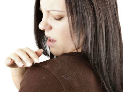 Vì sao tóc nhiều gàu?