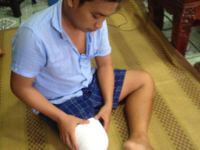 Vụ bệnh nhân bị cưa chân: Gia đình đề nghị khởi tố bác sĩ