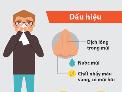 7 dấu hiệu cảnh báo bạn bị viêm xoang