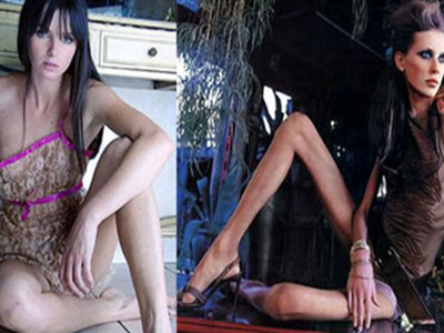 Bệnh cuồng ăn, chán ăn "hoành hành" giới nghệ sĩ