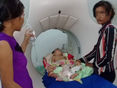 Lọt vào căm xe máy, bé 11 tháng tuổi nguy kịch